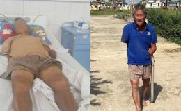 Ông lão cụt tay kẹp rắn hổ mang sau khi bị cắn ở Đà Nẵng, bệnh viện thông báo tình trạng sức khỏe và chi phí điều trị