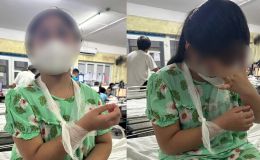 Huế: Cô giáo dùng thước gỗ đánh học sinh lớp 4 gãy tay, nhập viện, gia đình hé lộ nguồn cơn sự việc