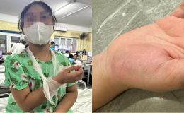 Vụ học sinh lớp 4 bị cô giáo đánh vào tay: Thông tin từ bệnh viện, giáo viên bất ngờ trước kết quả khám