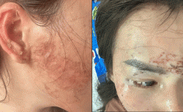 Vụ cô gái 'ngoại tình' bị người vợ xăm lên mặt và gây thương tích nặng kháng cáo toàn bộ bản án