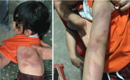 Bé gái lớp 2 bị bạn nam cùng lớp đánh bầm tím khắp người vì không ‘giữ lời hứa’, tình hình nạn nhân?