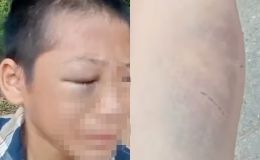 Cơ quan chức năng thông tin vụ bé trai lớp 6 cầu cứu vì bị bố và mẹ kế đánh đập, sợ hãi không dám về nhà