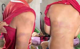 Vụ bé trai nghi bị bạo hành ở Nghệ An: Bà ngoại tiết lộ chi tiết khiến nhiều người nghẹn lòng