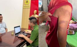 Diễn biến mới vụ mẹ cầu cứu nghi con trai bị bố ruột bạo hành sau khi ly hôn ở Nghệ An