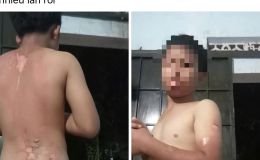 Công an thông tin vụ mẹ tạt nước sôi lên người khiến con trai bị bỏng ở Đắk Lắk 