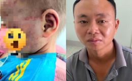 Diễn biến nóng vụ cha dượng tát, bóp cổ con riêng của vợ: Giám đốc Công an Gia Lai chỉ đạo khẩn