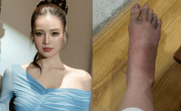 Netizen lo sốt vó khi Ninh Dương Lan Ngọc bất ngờ hé lộ thông tin từng giấu kín về sức khỏe