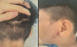 Bé trai 8 tuổi bị cha ruột đánh đến nhập viện: Bà ngoại kể lại cảnh tượng sau cuộc gọi cầu cứu