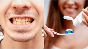 2 lỗi đánh răng phổ biến khiến răng bị ố vàng không phải ai cũng biết