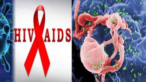 Nguyên nhân và triệu chứng của căn bệnh thế kỷ HIV mà bạn nên biết