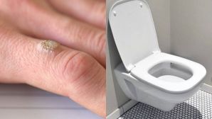 Bác sĩ tiết niệu cảnh báo: 90% bệ toilet công cộng chứa virus HPV, phụ nữ cần làm việc này để tránh lây nhiễm