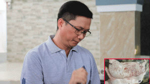 Đại diện C.P Việt Nam thừa nhận hình ảnh ‘tố’ heo bệnh là thật, chủ lò mổ chia sẻ thông tin nóng