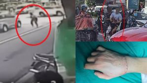 Camera ghi lại cảnh Tiktoker Hà List bị chém lìa tay: 30 giây ‘ra tay’ đầy lạnh lùng giữa phố 