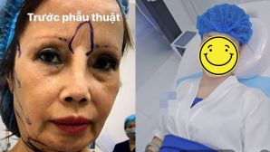 Cô dâu Thu Sao lại lên bàn mổ ở tuổi U70: Diện mạo hậu thẩm mỹ gây tranh cãi dữ dội!