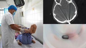 Phép màu xuất hiện với người phụ nữ đang làm vườn bị đạn bay trúng đầu, hé lộ tình hình hiện tại