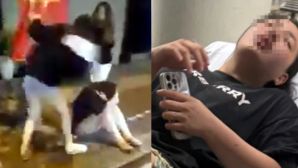 Nguồn cơn vụ ẩu đả tình ái ở Hà Nội: Cô gái 19 tuổi nhập viện sau trận đánh hội đồng, 2 người bị tạm giữ