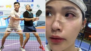Hot girl pickleball khóc thét khi bị đối thủ nam đánh bóng vào mắt, CĐM bùng nổ tranh cãi