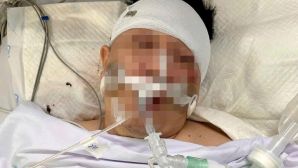 TPHCM: Tông trúng chó chạy rông, nam thanh niên nhập viện trong tình trạng 'ngàn cân treo sợi tóc'