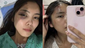 Người vợ bị chồng đánh chấn động não hé lộ tình tiết phẫn nộ, vợ cũ ra mặt vạch trần bản chất người đàn ông