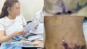 Bệnh viện Thẩm mỹ JT Angel bị tố, hé lộ những góc khuất 'công nghệ' kinh hoàng