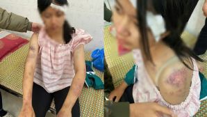 Chân dung bà nội và hai người đàn ông tra khảo, đánh đập cháu gái 13 tuổi dã man, lý do gây căm phẫn