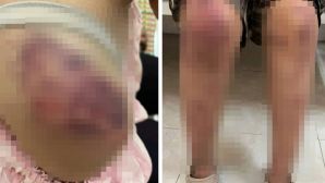 Vụ cháu bé 13 tuổi bị ông bà nội hành hạ dã man ở Thái Nguyên: Mức án nặng đang chờ các đối tượng?