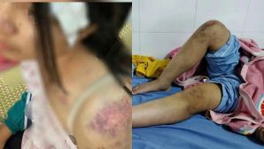 Sau vụ bé gái 12 tuổi ở Thái Nguyên bị bạo hành: Cư dân mạng bức xúc ‘bóc phốt’