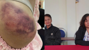 Lời kể xót xa của bà ngoại bé gái 14 tuổi bị nhà nội bạo hành dã man ở Thái Nguyên