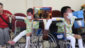 Bé trai 5 tuổi bị bỏng 65% trong vụ phóng hỏa Gia Lai hồi sinh ngoạn mục