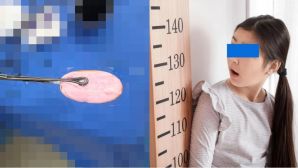 TP.HCM: Bé gái 12 tuổi cấp cứu vì nhét cục xà bông vào ‘nơi riêng tư’, bác sĩ cảnh báo khẩn