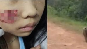 Con khỉ hoang ở Quảng Bình tấn công 5 người: Cháu bé 7 tuổi phải nhập viện với nhiều vết thương