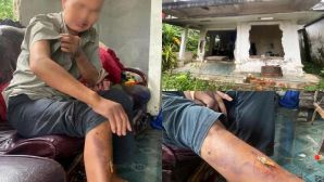 Vụ người đàn ông bị nhóm học sinh lột đồ, hành hung hơn 10 lần ở Huế: Hé lộ gia cảnh bất hảo