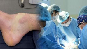 Nam thanh niên 32 tuổi dính chấn thương khi chơi pickleball, kết quả chụp MRI gây ngỡ ngàng