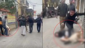 Nạn nhân vụ thả chó cắn người phải nhập viện chưa hết bàng hoàng kể chi tiết vụ việc, hé lộ nguồn cơn 