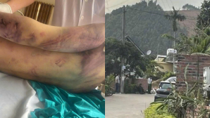 Nhân chứng vụ học viên tử vong sau 2 ngày nhập học: Bị đưa đi nơi khác sau sự việc