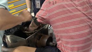 TP.HCM: Nam công nhân bị cuốn cả cánh tay vào máy xay thịt, ám ảnh tình trạng khi nhập viện cấp cứu