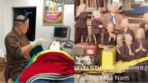 Sự thật về hình ảnh trụ trì chùa Cẩm La nâng mũi, làm răng sứ cho người dân, chính quyền yêu cầu nóng