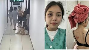 Chồng kéo lê đánh vợ dã man ở chung cư: Giám định 0% tổn thương, công an phường không nhận được đơn