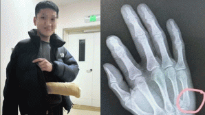 Ông bố nhập viện sau khi kèm con học, lời chia sẻ sau chấn thương 'đánh trúng tim đen' nhiều phụ huynh