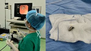 Một học sinh Đà Nẵng nhập viện vì thói quen ngậm đầu bút trong miệng, bác sĩ cảnh báo phụ huynh tuyệt đối không chủ quan