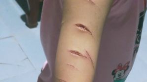 Xót xa vụ bé gái 12 tuổi bị chị họ rạch nát tay: Hiện trường phòng ngủ hé lộ sự thật ám ảnh