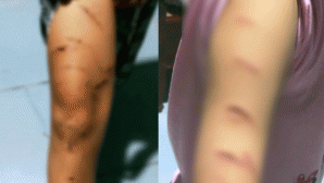 Chủ tịch UBND tỉnh Cà Mau lên tiếng vụ bé gái lớp 5 bị chị họ dùng dao cắt giấy rạch nhiều nhát