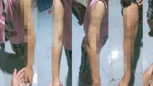 Phát hiện đáng sợ trong phòng ngủ bé gái lớp 5 bị chị họ dùng dao rạch toàn thân, xót xa hoàn cảnh nạn nhân