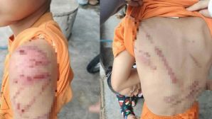 Chi chít vết bầm trên người bé trai 10 tuổi ở Đắk Lắk: Hé lộ sự thật phía sau, liên quan đến bố ruột