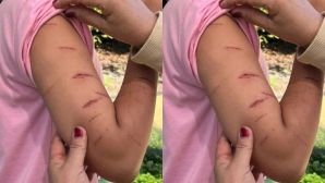 Sở Y tế Cà Mau thông tin nóng vụ nữ sinh bị chị họ rạch nát tay, bất ngờ với hoàn cảnh nạn nhân