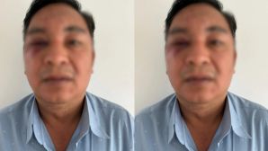 Công an xác định nguồn cơn vụ 2 nam 1 nữ xông vào đánh, nổ súng với một người đàn ông ở Đồng Nai