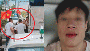 Hải Phòng: 4 gã đàn ông nhổ nước bọt, đánh đập tài xế lái xe tải dù đã được chủ động nhường đường