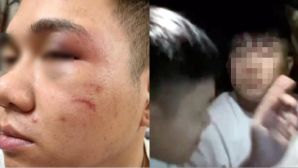Tài xế hứng đòn vì từ chối chở người say xỉn: Nạn nhân bị người phụ nữ giữ lại để nam thanh niên ra tay
