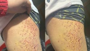 Thông tin học sinh nghi bị bạn dùng vật nhọn gây thương tích ở Lào Cai: Chính quyền lên tiếng