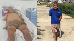 Ông lão cụt tay kẹp rắn hổ mang sau khi bị cắn ở Đà Nẵng, bệnh viện thông báo tình trạng sức khỏe